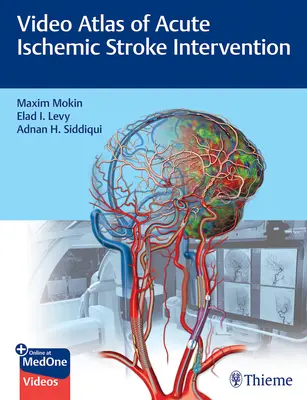 Video Atlas intervencie pri akútnej ischemickej mozgovej príhode - Video Atlas of Acute Ischemic Stroke Intervention