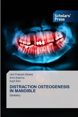 Distrakčná osteogenéza v čeľusti - Distraction Osteogenesis in Mandible