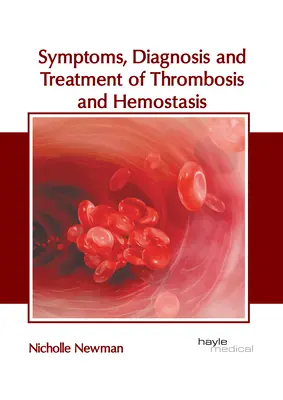 Príznaky, diagnostika a liečba trombózy a hemostázy - Symptoms, Diagnosis and Treatment of Thrombosis and Hemostasis