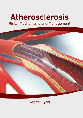 Ateroskleróza: Ateroskleróza: riziká, mechanizmy a liečba - Atherosclerosis: Risks, Mechanisms and Management