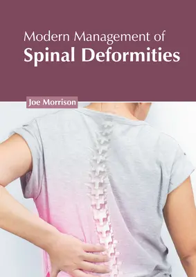 Moderný manažment deformít chrbtice - Modern Management of Spinal Deformities