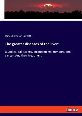Väčšie choroby pečene: Žltačka, žlčové kamene, zväčšenia, nádory a rakovina: A ich liečba - The greater diseases of the liver: Jaundice, gall-stones, enlargements, tumours, and cancer: And their treatment