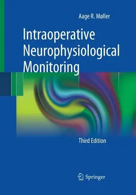Intraoperačné neurofyziologické monitorovanie - Intraoperative Neurophysiological Monitoring
