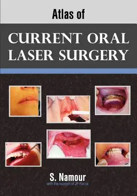 Atlas súčasnej ústnej laserovej chirurgie - Atlas of Current Oral Laser Surgery