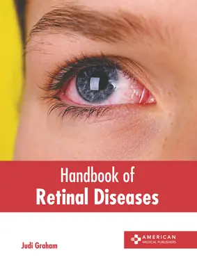 Príručka o ochoreniach sietnice - Handbook of Retinal Diseases