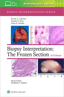 Interpretácia biopsie: Zmrazený rez - Biopsy Interpretation: The Frozen Section