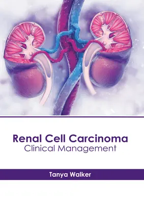 Karcinóm z obličkových buniek: klinický manažment - Renal Cell Carcinoma: Clinical Management