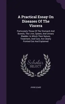 A Practical Essay On Diseases Of the Viscera (Praktická esej o chorobách vnútorných orgánov): Najmä žalúdka a čriev, pečene, sleziny a močového mechúra: v ktorej sa uvádza ich prirodzená - A Practical Essay On Diseases Of The Viscera: Particularly Those Of The Stomach And Bowels, The Liver, Spleen, And Urinary Bladder: In Which Their Nat