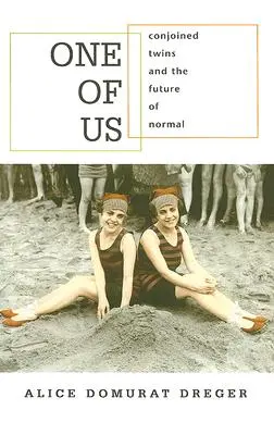 Jeden z nás: Spojené dvojčatá a budúcnosť normálneho života - One of Us: Conjoined Twins and the Future of Normal