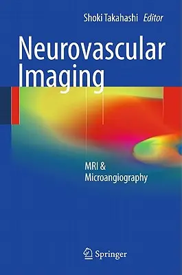 Neurovaskulárne zobrazovanie: MRI a mikroangiografia - Neurovascular Imaging: MRI & Microangiography