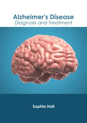 Alzheimerova choroba: Alzheimerova choroba: diagnostika a liečba - Alzheimer's Disease: Diagnosis and Treatment