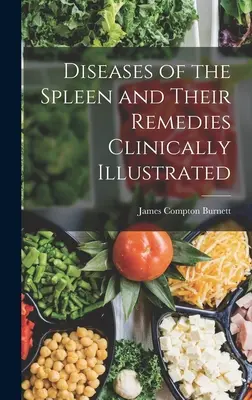 Choroby sleziny a ich liečba klinicky znázornené - Diseases of the Spleen and Their Remedies Clinically Illustrated