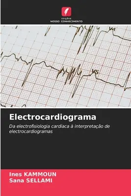 Elektrokardiografia - Electrocardiograma