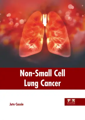 Nemalobunkový karcinóm pľúc - Non-Small Cell Lung Cancer