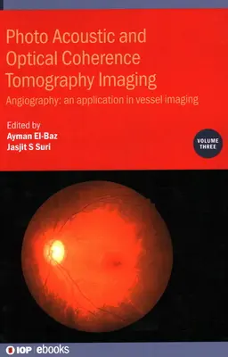 Fotoakustické a optické koherentné tomografické zobrazovanie: Angiografia: - aplikácia v zobrazovaní ciev - Photo Acoustic and Optical Coherence Tomography Imaging: Angiography: - An Application in Vessel Imaging