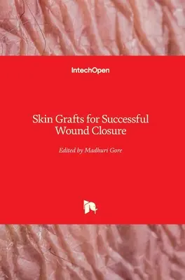 Kožné transplantáty pre úspešné uzavretie rany - Skin Grafts for Successful Wound Closure