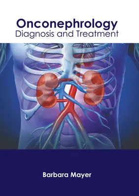 Onkonefrológia: Diagnostika a liečba - Onconephrology: Diagnosis and Treatment