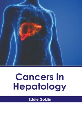 Rakovina v hepatológii - Cancers in Hepatology