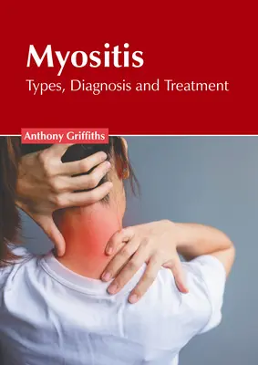 Myozitída: Typy, diagnostika a liečba - Myositis: Types, Diagnosis and Treatment
