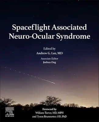 Neuro-okulárny syndróm spojený s vesmírnymi letmi - Spaceflight Associated Neuro-Ocular Syndrome