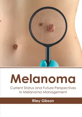 Melanóm: Súčasný stav a budúce perspektívy liečby melanómu - Melanoma: Current Status and Future Perspectives in Melanoma Management