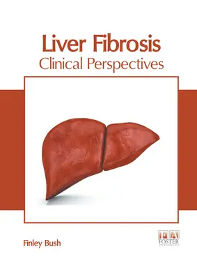 Fibróza pečene: Klinické perspektívy - Liver Fibrosis: Clinical Perspectives