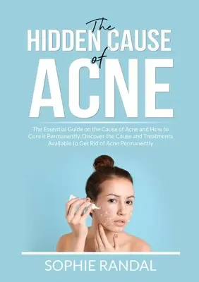 Skrytá príčina akné: Základná príručka o príčine akné a o tom, ako ho natrvalo vyliečiť, Objavte príčinu a dostupné spôsoby liečby t - The Hidden Cause of Acne: The Essential Guide on the Cause of Acne and How to Cure it Permanently, Discover the Cause and Treatments Available t