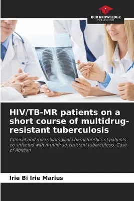 Pacienti s HIV/TB-MR na krátkej liečbe multirezistentnej tuberkulózy - HIV/TB-MR patients on a short course of multidrug-resistant tuberculosis