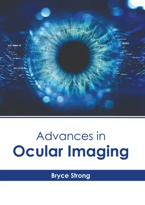 Pokroky v očnom zobrazovaní - Advances in Ocular Imaging