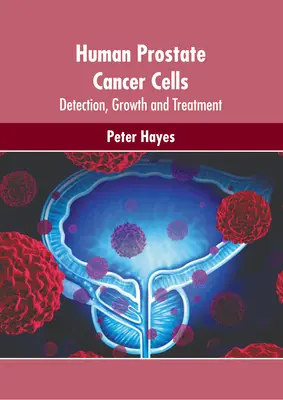 Ľudské bunky rakoviny prostaty: Zistenie, rast a liečba - Human Prostate Cancer Cells: Detection, Growth and Treatment