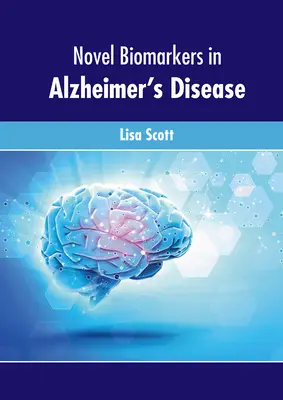 Nové biomarkery pri Alzheimerovej chorobe - Novel Biomarkers in Alzheimer's Disease