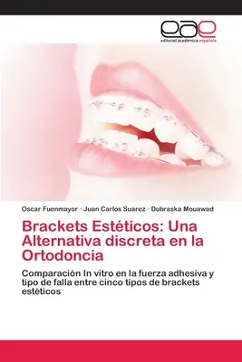 Brackets Estticos: Una Alternativa discreta en la Ortodoncia
