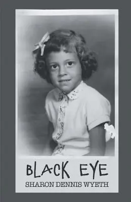Čierne oko - Black Eye