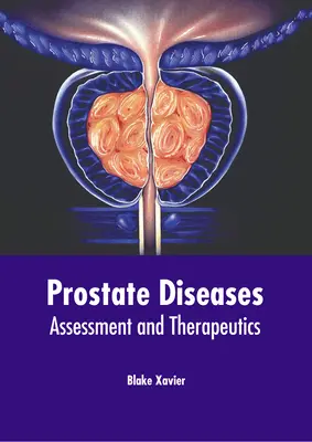 Choroby prostaty: Pľúcne choroby: hodnotenie a terapia - Prostate Diseases: Assessment and Therapeutics