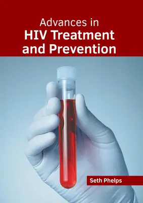 Pokroky v liečbe a prevencii HIV - Advances in HIV Treatment and Prevention