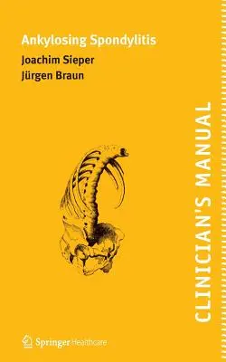 Príručka klinického lekára o ankylozujúcej spondylitíde - Clinician's Manual on Ankylosing Spondylitis