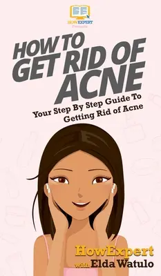 Ako sa zbaviť akné: Váš sprievodca krok za krokom, ako sa zbaviť akné - How To Get Rid of Acne: Your Step By Step Guide To Getting Rid of Acne