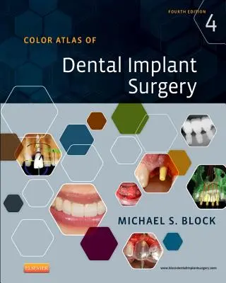 Farebný atlas chirurgie zubných implantátov - Color Atlas of Dental Implant Surgery