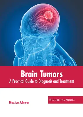 Nádory mozgu: Praktický sprievodca diagnostikou a liečbou - Brain Tumors: A Practical Guide to Diagnosis and Treatment