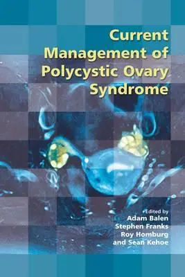 Súčasný manažment syndrómu polycystických vaječníkov - Current Management of Polycystic Ovary Syndrome