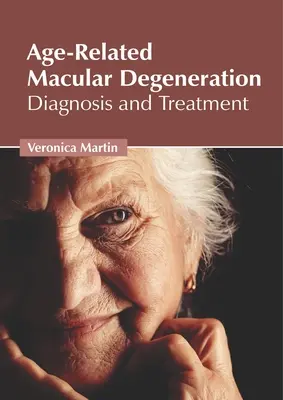 Vekom podmienená makulárna degenerácia: Diagnóza a liečba - Age-Related Macular Degeneration: Diagnosis and Treatment