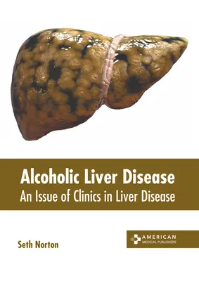 Alkoholová choroba pečene: An Issue of Clinics in Liver Disease - Alcoholic Liver Disease: An Issue of Clinics in Liver Disease