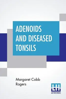 Adenoidy a choré mandle: Woodworth: Ich vplyv na všeobecnú inteligenciu, Edited by R. S. Woodworth - Adenoids And Diseased Tonsils: Their Effect On General Intelligence, Edited By R. S. Woodworth