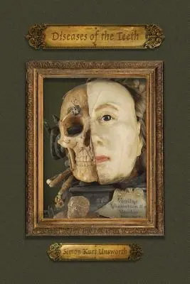 Choroby zubov - Diseases of the Teeth