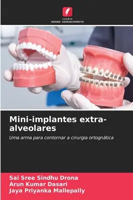 Miniimplantáty extra-alveolares - Mini-implantes extra-alveolares