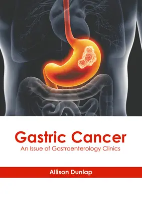 Rakovina žalúdka: Vydanie Gastroenterologickej kliniky - Gastric Cancer: An Issue of Gastroenterology Clinics