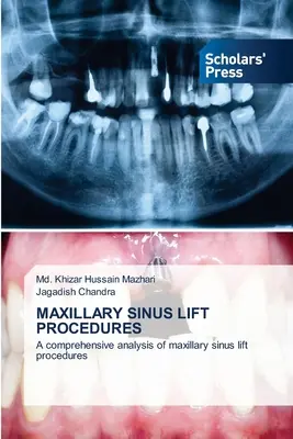 Zákroky na zdvihnutie čeľustnej dutiny - Maxillary Sinus Lift Procedures