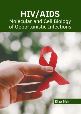 Hiv/Aids: Híd: molekulárna a bunková biológia oportúnnych infekcií - Hiv/Aids: Molecular and Cell Biology of Opportunistic Infections