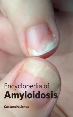 Encyklopédia amyloidózy - Encyclopedia of Amyloidosis