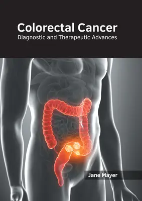 Rakovina hrubého čreva: Diagnostické a terapeutické pokroky - Colorectal Cancer: Diagnostic and Therapeutic Advances